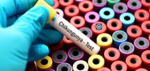 Read more about the article CDC Warns of Growing Chikungunya Threat Amid Global Travel and Climate Change
